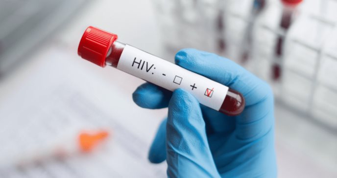 ¿Cuándo el VIH progresa a SIDA? Diferencias, tratamiento antirretroviral y todo lo que debe saber