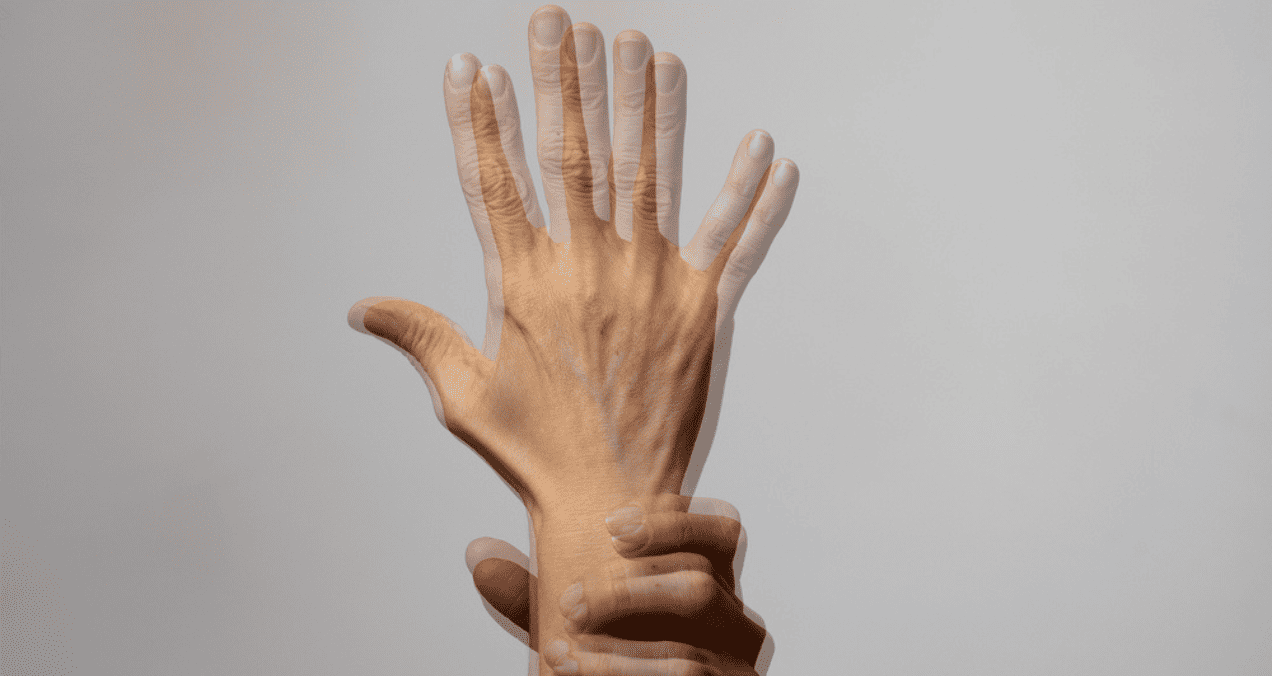Notas movimientos involuntarios en tus extremidades? ¡Podría ser el  síndrome de la mano loca!