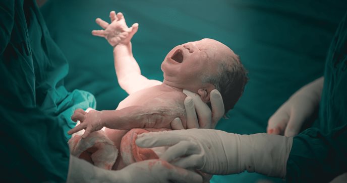 Siembra vaginal: la controvertida práctica para restaurar la microbiota de los recién nacidos por cesárea