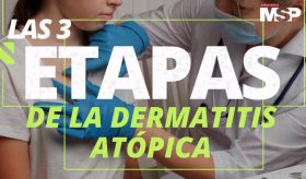 Así son las 3 etapas de la dermatitis atópica - #ExclusivoMSP