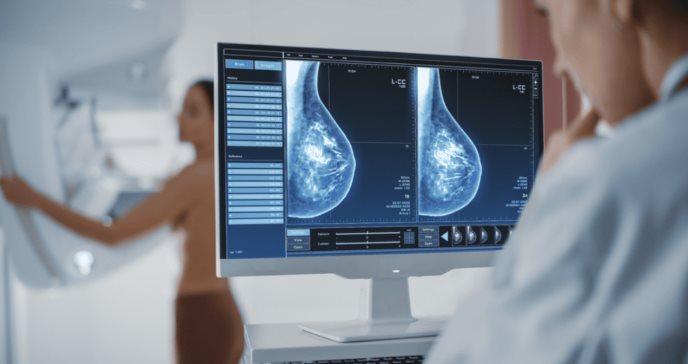 Sobrediagnóstico de cáncer de seno: ¿Cuáles son los riesgos de recibir tratamientos innecesarios?