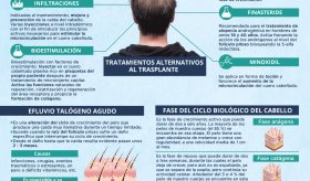 Radiografía de la caída del cabello | Infografía