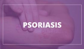Lo que debes saber de la psoriasis | #ProtegeTuPiel