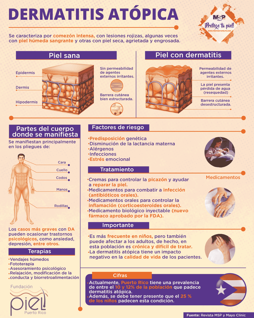 Dermatitis At Pica