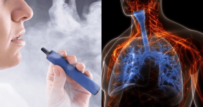 El consumo de cigarrillos electrónicos puede llevar al colapso pulmonar