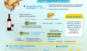 Pancreatitis crónica | Infografía