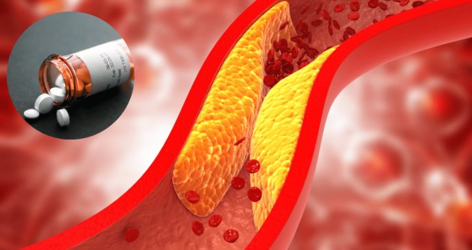 Muvalaplin, fármaco en investigación podría reducir más de un 50 % los niveles de colesterol Lp(a)