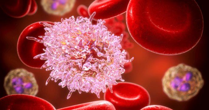 Avances terapéuticos y nuevas opciones de tratamiento en la lucha contra la leucemia linfocítica crónica