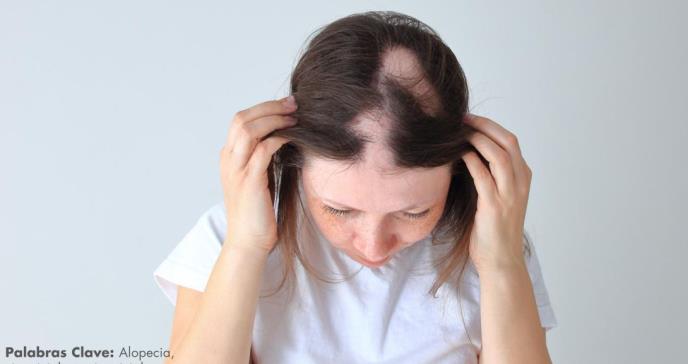 La alopecia: causas más comunes y su tratamiento