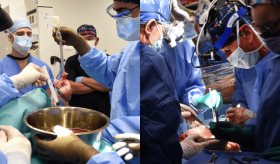 Xenotrasplante: Con éxito realizan segundo trasplante de un corazón de cerdo a paciente vivo