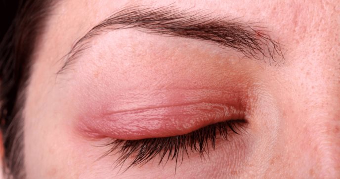Los 7 distintos tipos de infecciones oculares que pueden causar pérdida permanente de la visión