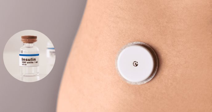 Dispositivo implantable podría eliminar la necesidad de inyecciones de insulina en pacientes con diabetes