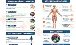 parálisis cerebral mixta