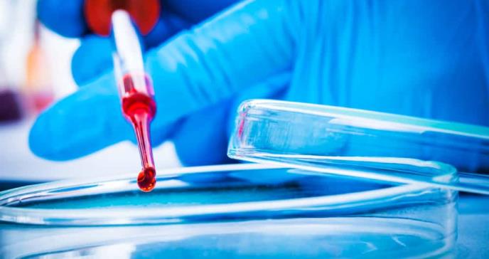 Biopsia líquida: el análisis de sangre experimental que permitió detectar el cáncer sin síntomas