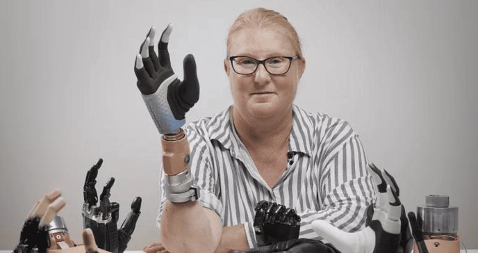 Innovador brazo biónico se fusiona con esqueleto y permite conexión eléctrica con el sistema nervioso