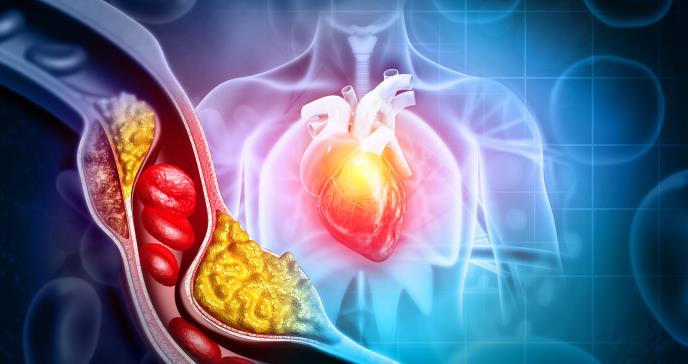 Por primera vez definen síndrome cardiovascular-renal-metabólico (CKM) y redefinen riesgo cardiovascular