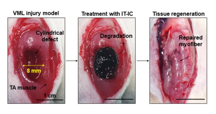 Desarrollan prótesis de tejido inyectable biodegradable para la recuperación de lesiones o daño muscular