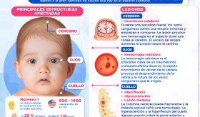 Síndrome del niño zarandeado | Infografía