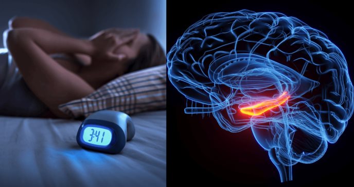 Falta de sueño o pérdida de sueño provoca daños neurológicos en el hipocampo del cerebro