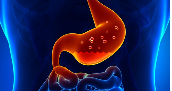 Qué es la gastritis y por qué la producción excesiva de ácido estomacal provoca úlceras gastroduodenales