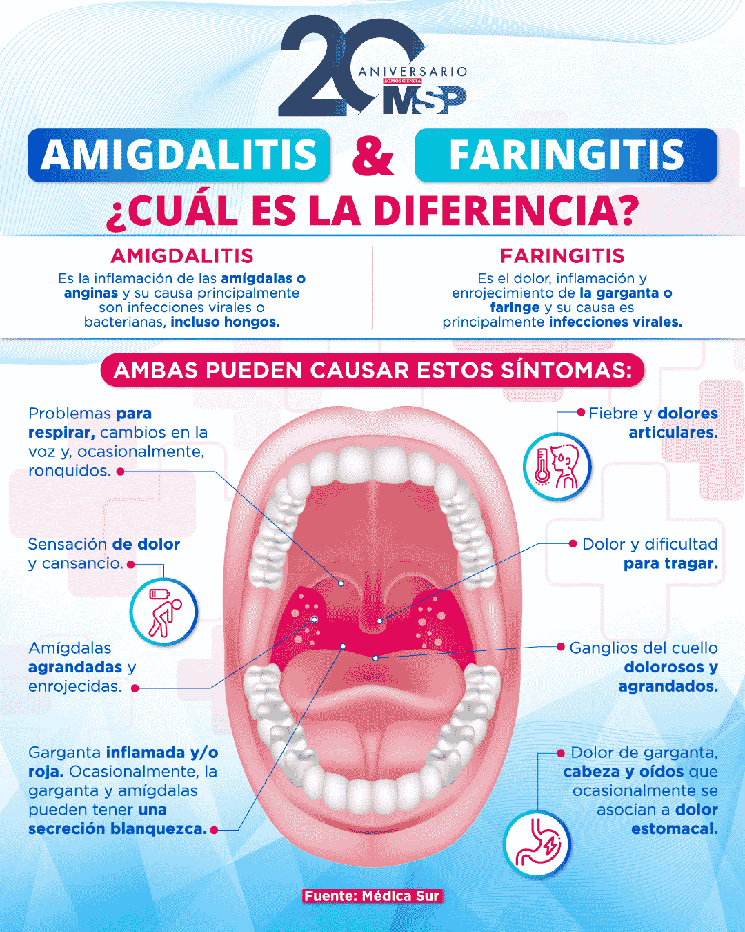 Amigdalitis y faringitis ¿Cuál es la diferencia?