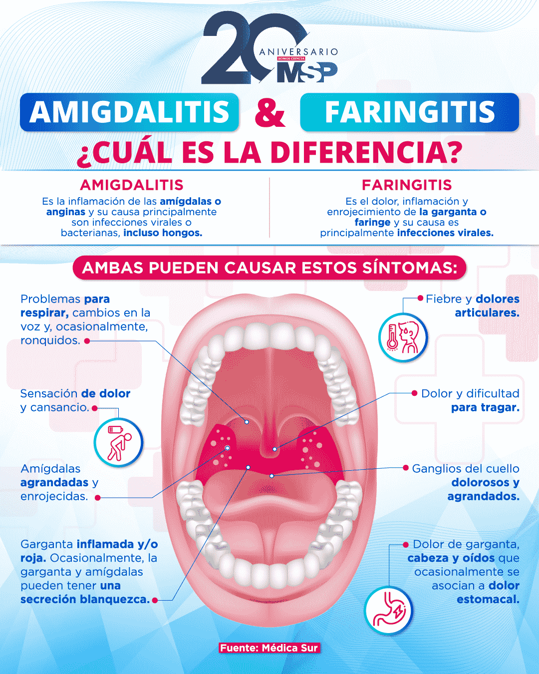 Amigdalitis Y Faringitis ¿cuál Es La Diferencia