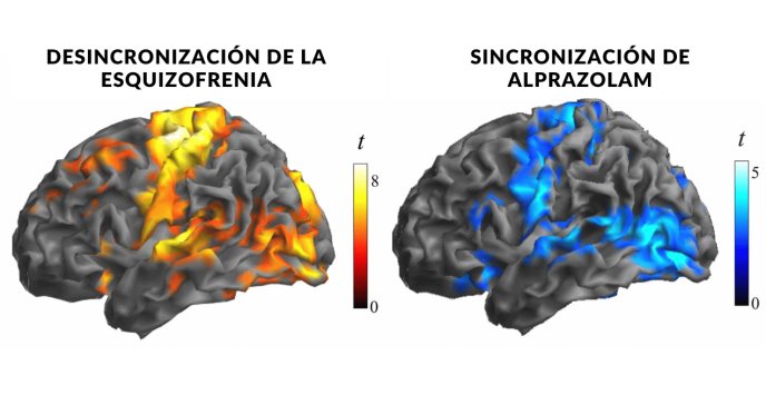 Esquizofrenia: Descubren afectación en neuronas inhibidoras que sería responsable de los síntomas