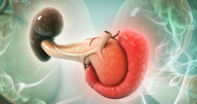 Pancreatitis aguda y las causas de un páncreas con inflamación severa