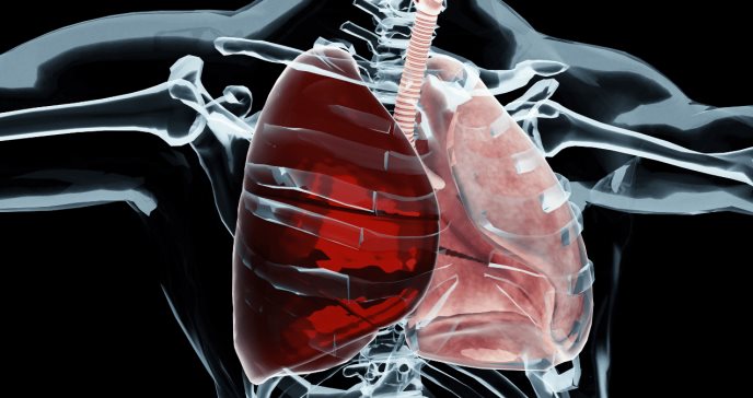 ¿Qué es el hemotórax y por qué una disonancia en la función pulmonar exige respuesta inmediata?