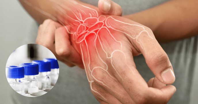 ¿Biológico Abatacept logra reducir el desarrollo de artritis reumatoide en personas con riesgo?