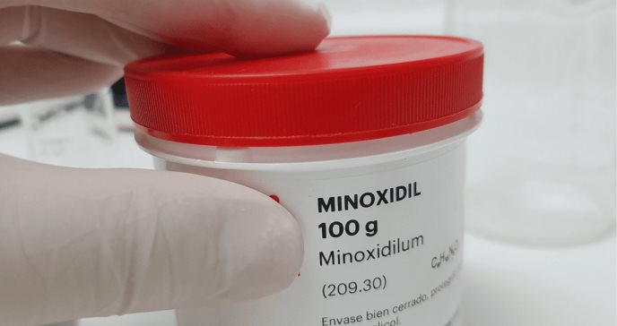 ¿Cómo funciona el Minoxidil para tratar diferentes tipos de alopecia y para quién está contraindicado?
