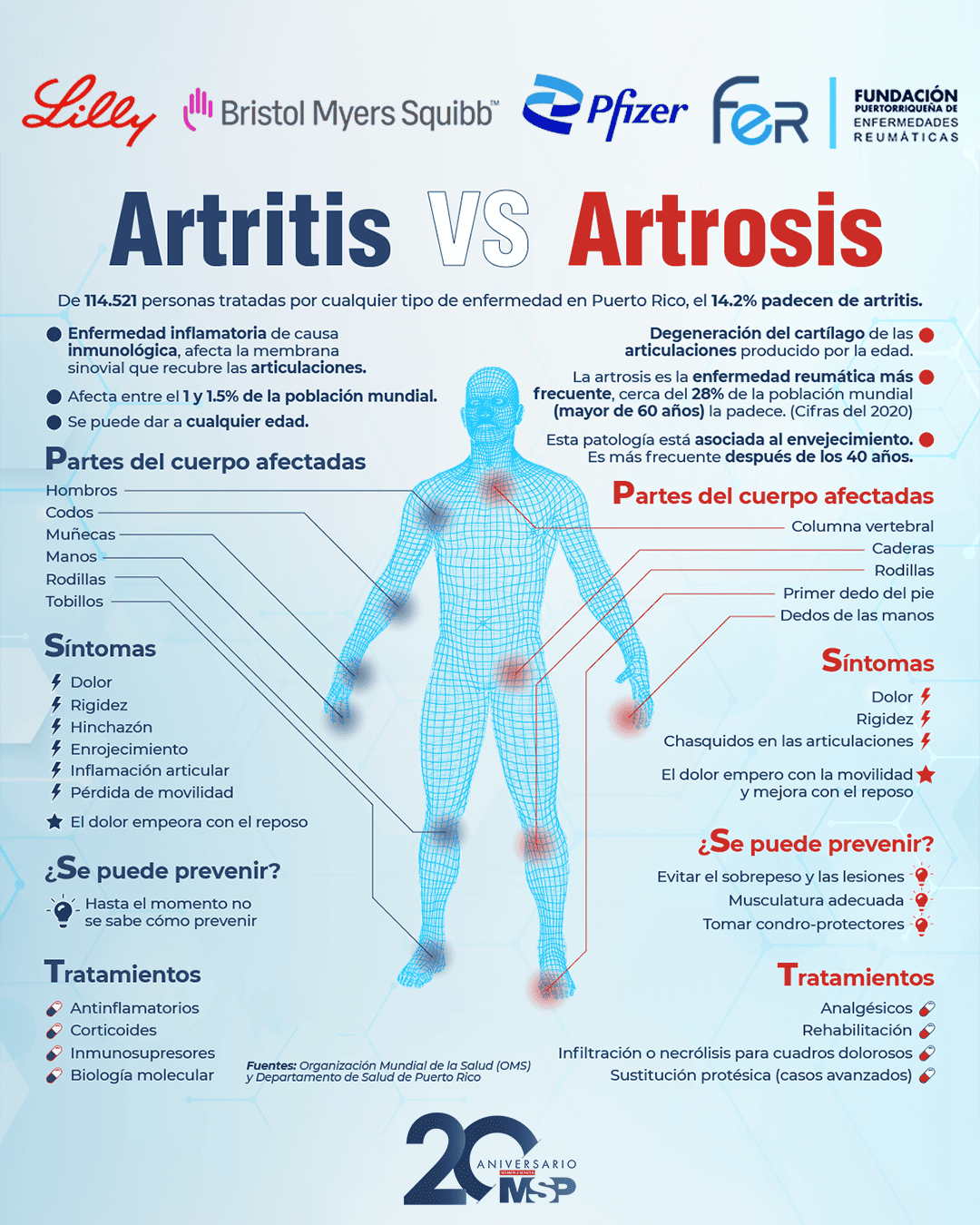 Artritis Vs Artrosis 6137