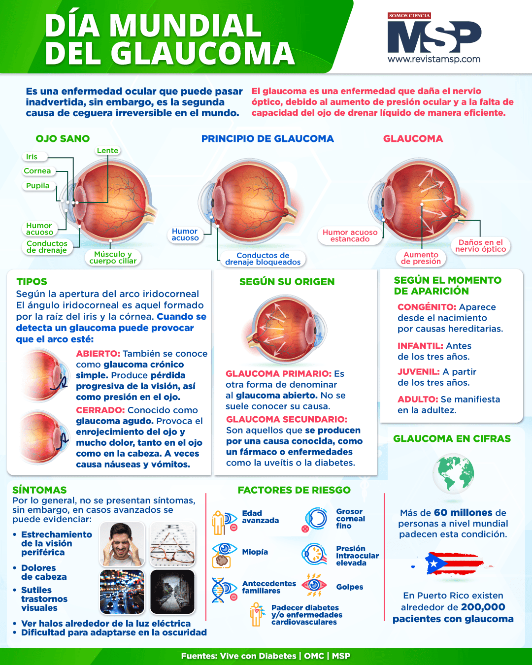 Día mundial del glaucoma