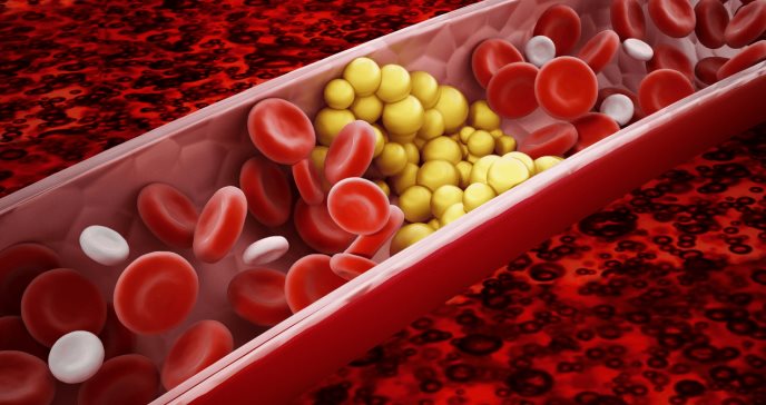 Nuevo estudio revela la relación entre COVID-19 persistente con los lípidos en sangre
