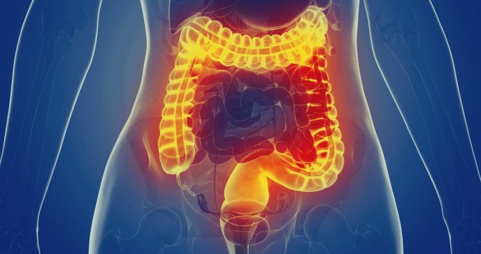 Manifestaciones extraintestinales del Síndrome del Intestino Irritable: más que un problema digestivo