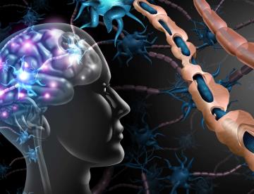 Esclerosis múltiple podría detectarse años antes de su desarrollo con una prueba de sangre