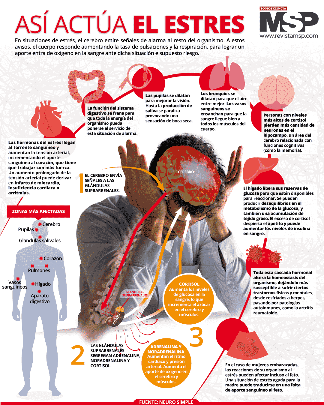 Así actúa el estrés