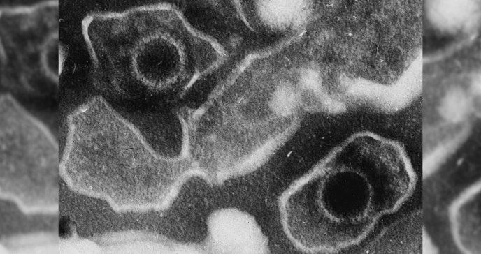 Nuevo enfoque en manejo del virus Epstein-Barr con inhibidores de IDO1 reduciría la carga viral 