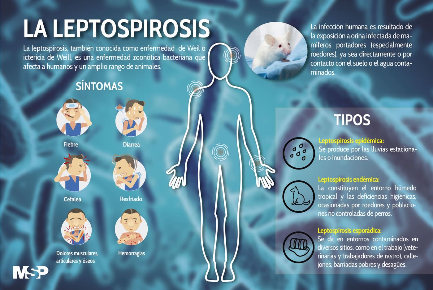 La Leptospirosis
