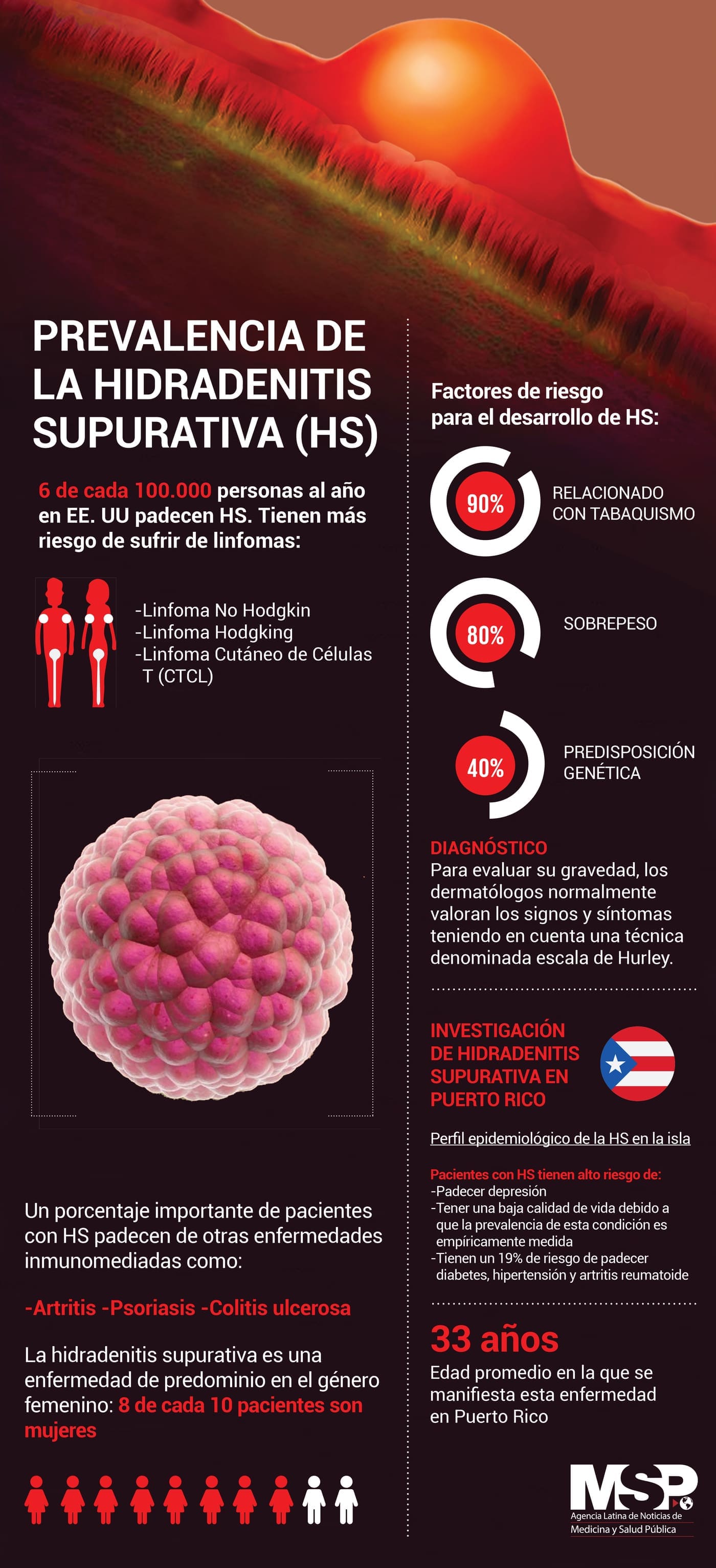 Prevalencia de la Hidradenitis Supurativa (HS)